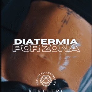 Diatermia (por zona afectada)